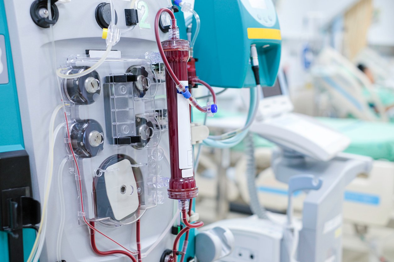 What Is Dialysis Critical Care? A Complete Guide to Dialysis Critical Care Services