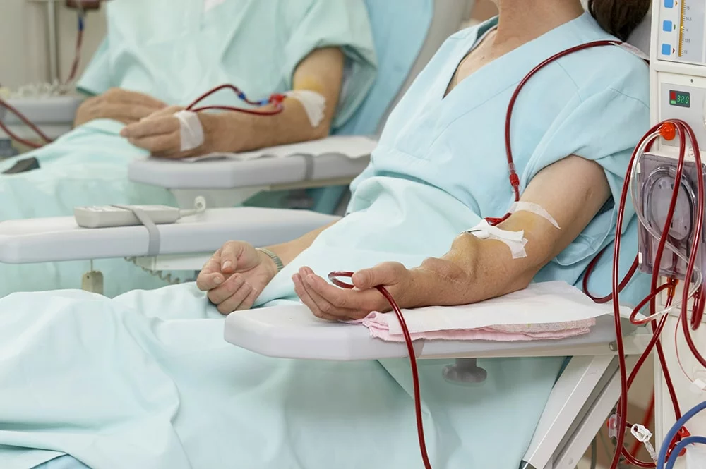 Top 7 Benefits of Dialysis Critical Care Services for Patients With Kidney Failure
