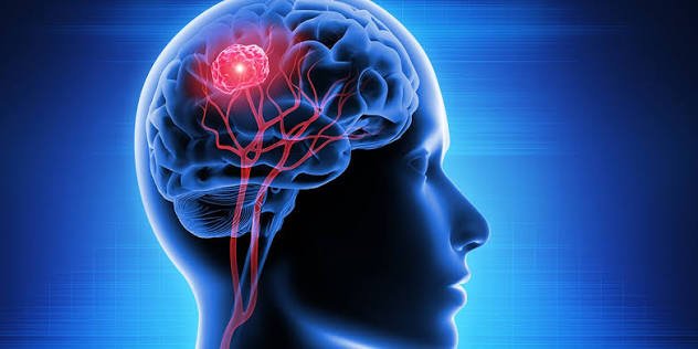 Neuro Critical Care